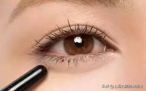 孙沣博士：双眼皮手术后，眼睛总爱流泪是正常情况吗？