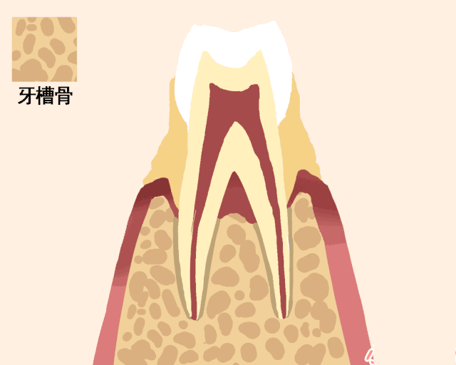 牙齿松动要拔掉吗？牙齿松动拔牙好不好？-错位严重的牙齿能拔掉吗