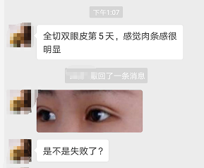 双眼皮肉条OR肿胀应该如何判断，两者有什么区别？-割双眼皮肉条感什么样子