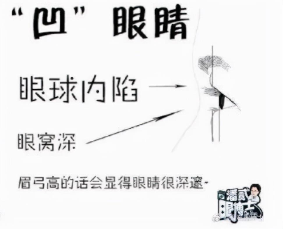 关于“双眼皮修复”的这个细节，一般医生不会讲-双眼皮下垂怎么自然恢复