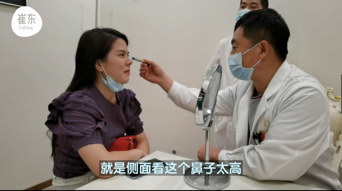 崔东案例分享：一台典型的朝天鼻修复案例-朝天鼻隆鼻难度大？