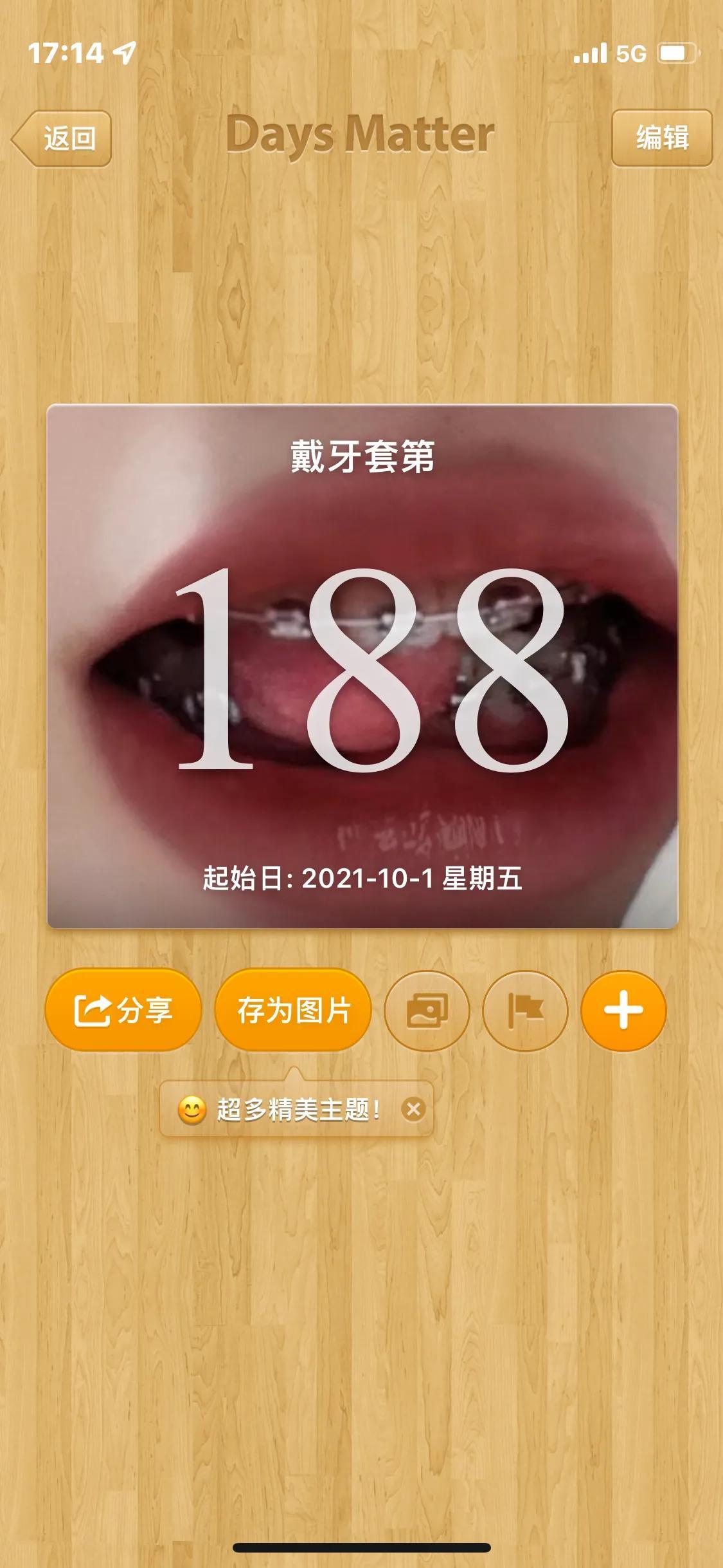 南宁矫正之牙套日记#口腔护理-南宁市矫正牙齿大概多少钱