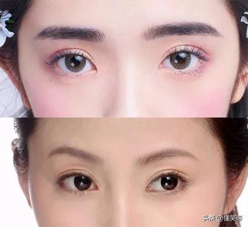 女子花3000块做双眼皮，不满意效果起诉要求医生吃花生米-割双眼皮价钱大概多少