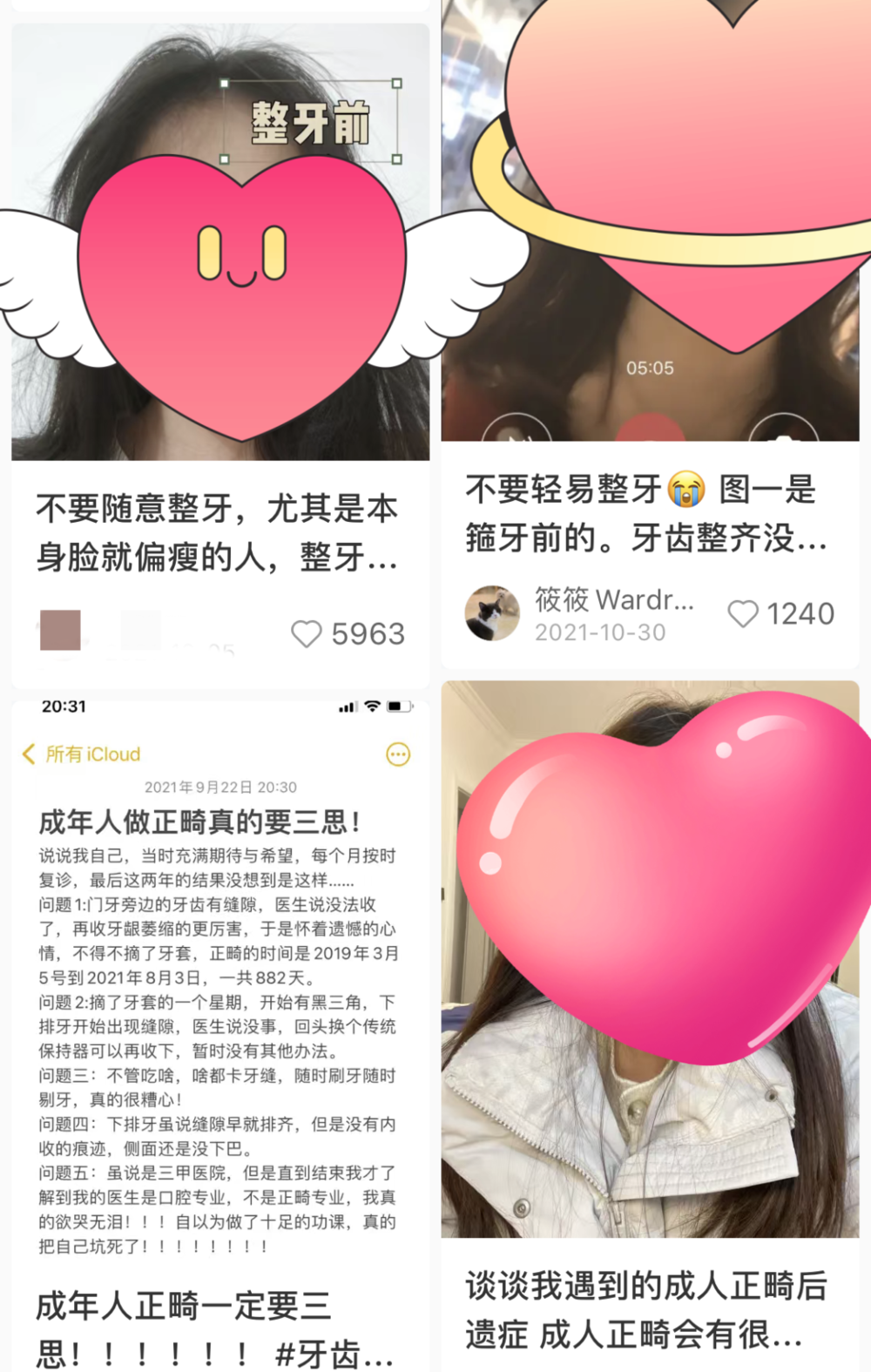 20岁的时候戴上牙套，谁不知道有多惨？-25岁做牙齿矫正晚吗女