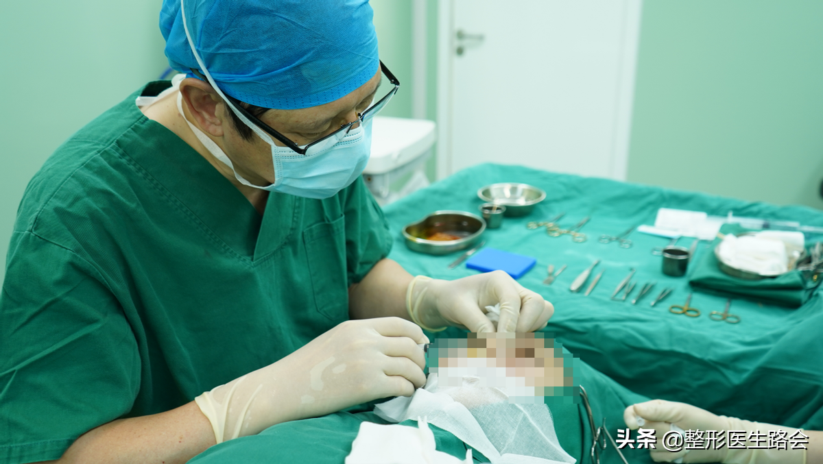 24岁小伙子隆鼻真实记录，术后90天效果很“惊艳”-真皮隆鼻价格