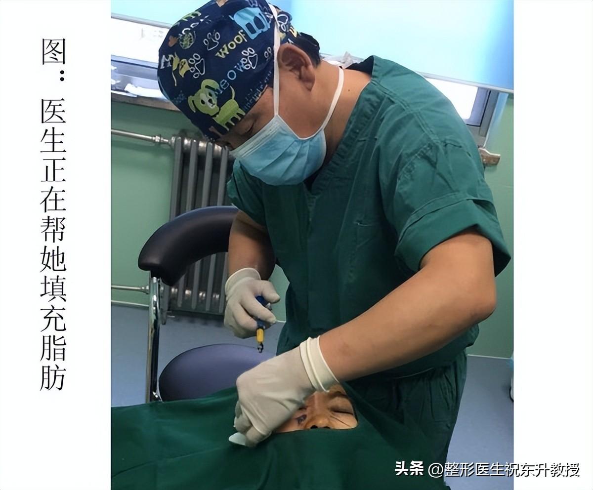 自体脂肪填充全脸后，是如何一天天恢复好的？都有哪些注意事项？-自体脂肪填充做完注意事项