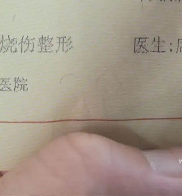 今天到了医院挂了烧伤整形的号打算做一个开眼角和双眼皮的手术-开眼角双眼皮费用