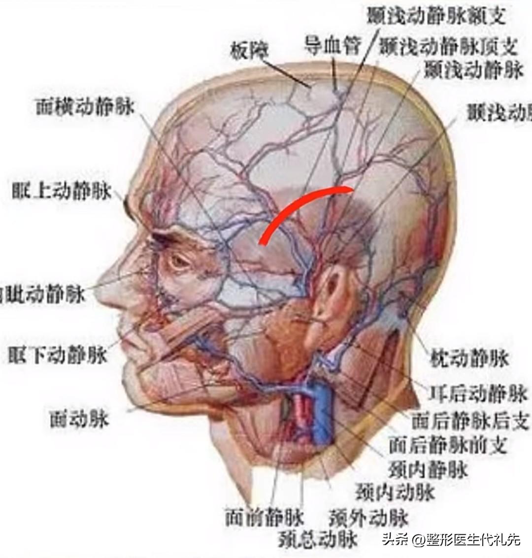 为什么玻尿酸填充太阳穴容易打进血管里？-玻尿酸太阳穴填充太阳穴