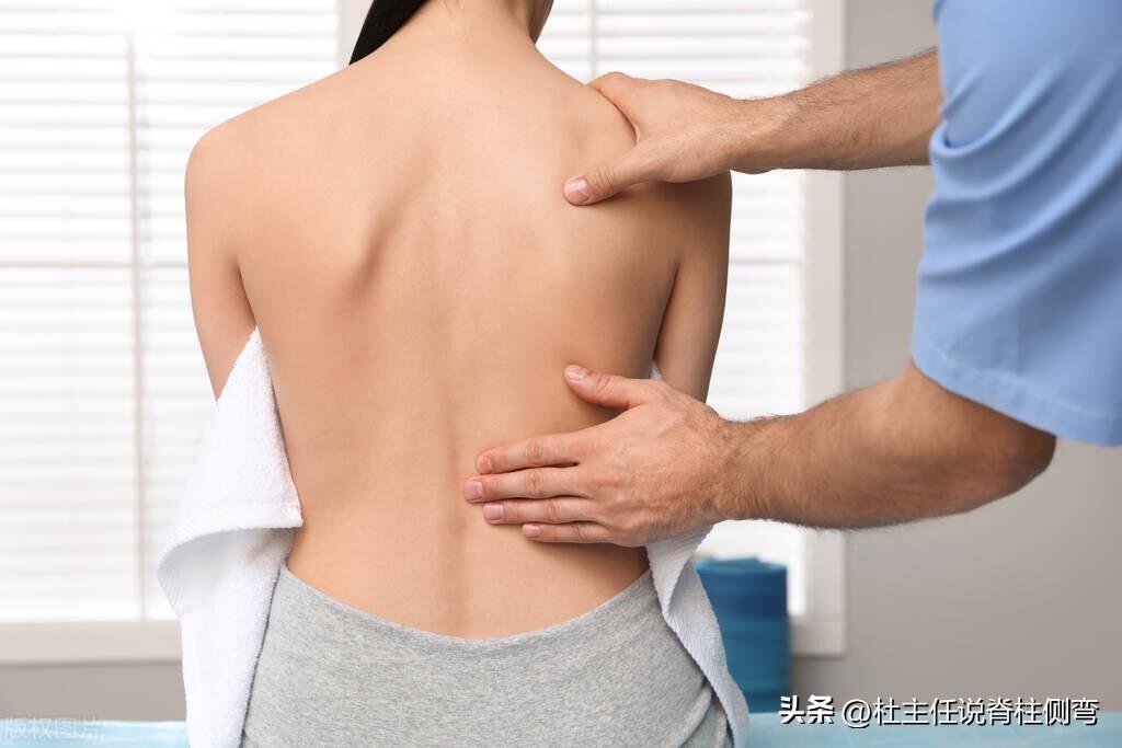 14岁女孩S型侧弯36°，矫正十个月降至16°，体表完全恢复-14岁能矫正牙齿吗女