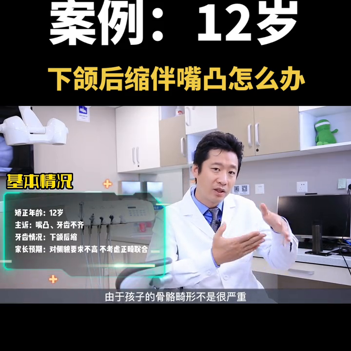 案例｜12岁下颌后缩伴嘴凸怎么办？@DOU+小助手