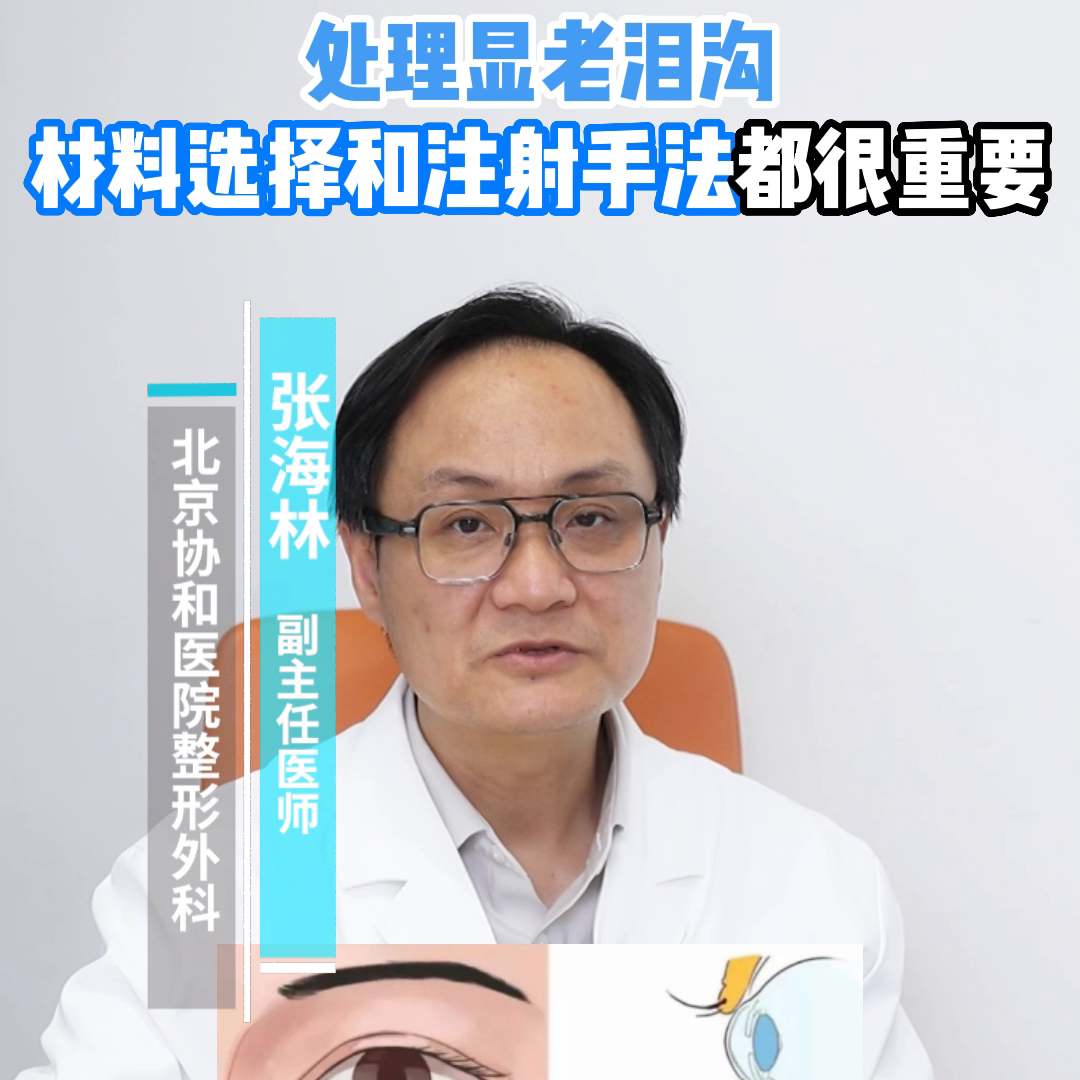 玻尿酸填充泪沟：浅层+深层注射才能更好防止并发症的发生...-玻尿酸填充注射方法