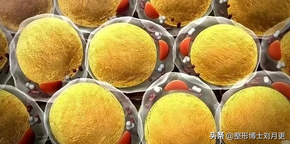 深圳军科整形医院：关于吸脂，你真的完全了解吗？-深圳吸脂要花多少钱