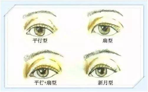 济南海峡整形分享：双眼皮这样做才好看-割双眼皮那些比较好的方法