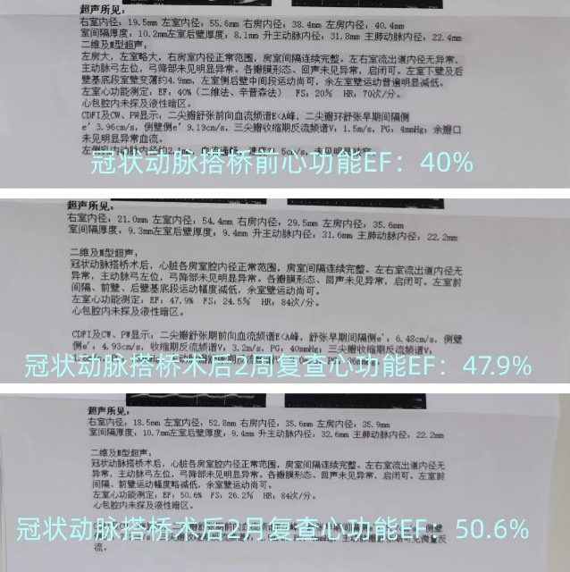 “心动力，心希望”——阳光融和医院心脏大血管外科顺利完成主动脉球囊反搏（IABP）辅助下冠状动脉搭桥术-阳光天使基金
