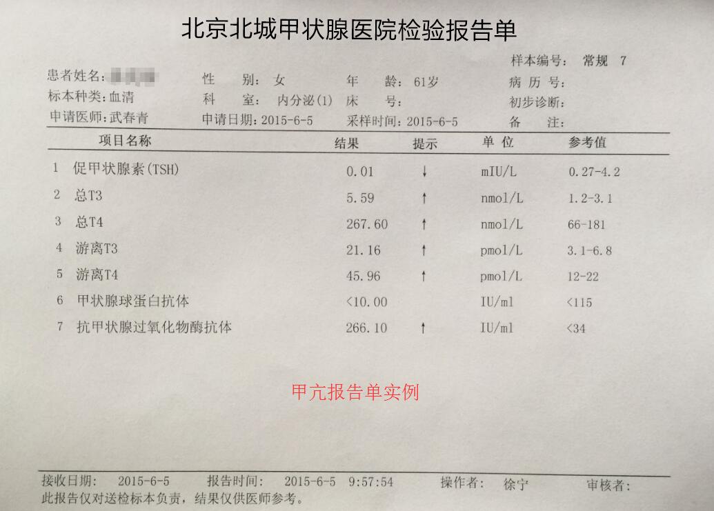 甲状腺大小正常值范围，甲状腺正常值多少（甲状腺专家教你一分钟读懂甲状腺化验单）