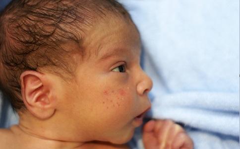 新生儿黄疸怎么退的快，婴儿黄疸的治疗方法（新生儿黄疸 三种疗法积极治疗）
