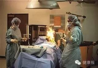 屁能点燃吗，屁真的可以点燃吗（手术室一言不合着火了）