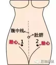 胎心监护宫缩压多少正常，孕妇宫缩压是多少（胎心监护可判断胎儿是否缺氧）