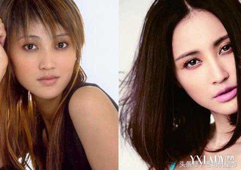 咱们相爱吧大结局，咱们相爱吧大结局视频（张歆艺惹议论：整容后遗症吧）