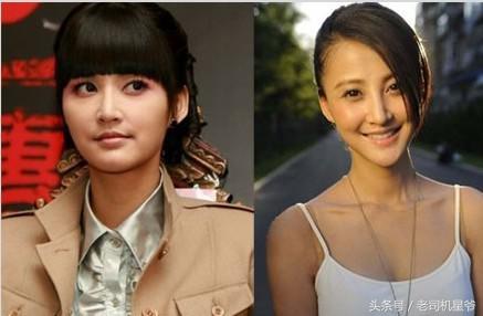 咱们相爱吧大结局，咱们相爱吧大结局视频（张歆艺惹议论：整容后遗症吧）