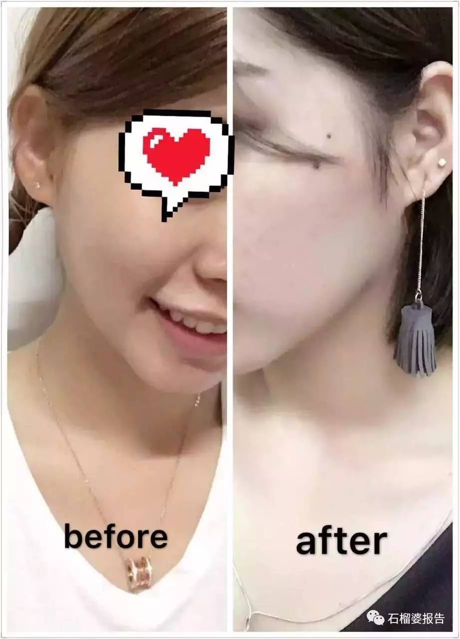 coach是什么牌子，coach是什么牌子手表多少钱女士（读者来稿，我这样变成了白皮妹）