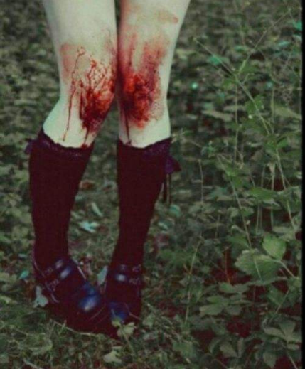 梦见手指受伤什么意思，梦见手指受伤了的预兆（梦见自己身上流血）