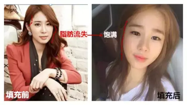 李光洙女友刘仁娜，李光洙女朋友（从假小子到《鬼怪》炸鸡店女老板）