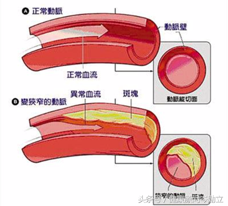 敲打肝经的正确方法图片，敲肝经的正确方法图解（敲肝经是最好的方法）
