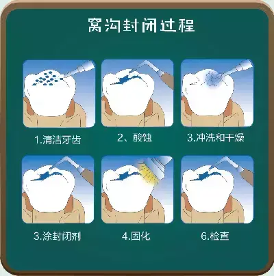 做窝沟封闭把孩子坑了，孩子做窝沟封闭有必要吗（小心孩子恨你一辈子）