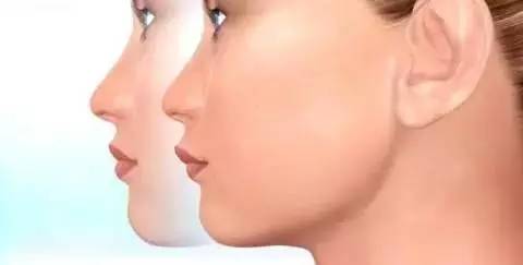 怎么样改变脸型，如何改变脸型（一步一步细节告诉你牙齿矫正是如何改变脸型的）