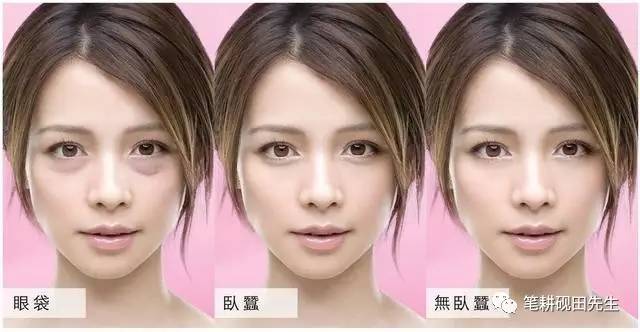 真卧蚕不笑时有吗，卧蚕不笑的时候没有算是卧蚕吗（据说美人都有这块肉）