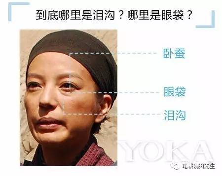 真卧蚕不笑时有吗，卧蚕不笑的时候没有算是卧蚕吗（据说美人都有这块肉）