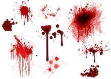 晚上做梦梦到被狗咬是什么意思 晚上做梦梦到被狗咬是什么征兆，晚上做梦梦到被狗咬是什么意思（梦是什么？千奇百怪的梦境解读）