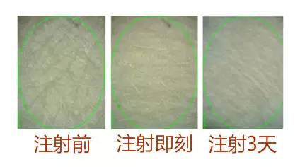 无针水光是什么，什么是无针水光（范冰冰35岁素颜白到发光）