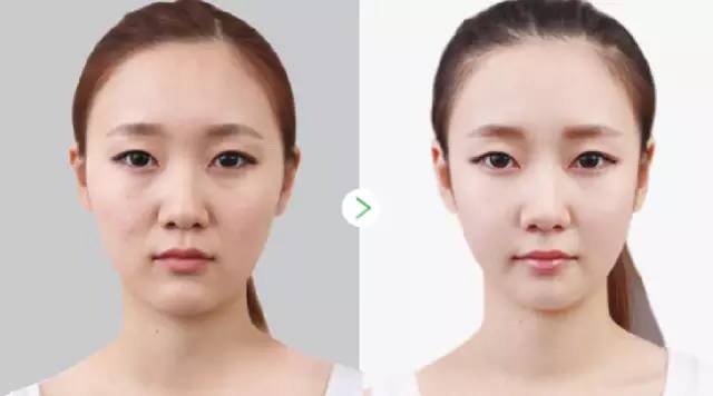 无针水光是什么，什么是无针水光（范冰冰35岁素颜白到发光）