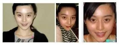 无针水光是什么，什么是无针水光（范冰冰35岁素颜白到发光）