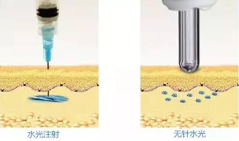 无针水光是什么，什么是无针水光（范冰冰35岁素颜白到发光）