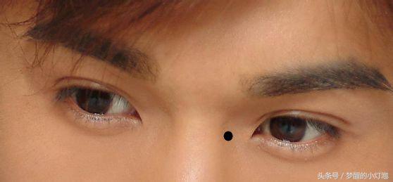 左眼角长痣