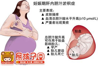 怀孕36周肚皮很痒怎么护理，怀孕36周肚子痒怎么缓解（有可能是“致命之痒”）