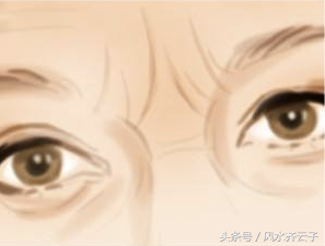 两眉间有两竖道纹是什么兆头，两眉间有两道竖纹面相（查己识人都应知道的面相知识）