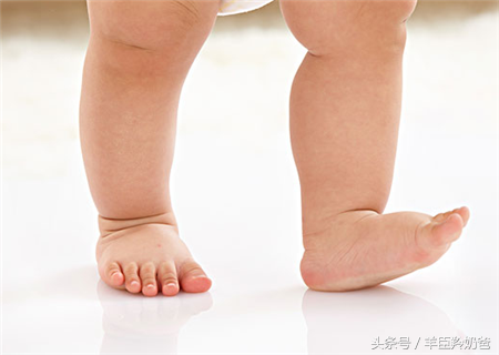 婴儿足内翻怎么治疗，婴儿足内翻治疗方法（婴儿足内翻并不是小病小痛）