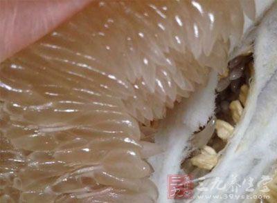 孕期吃什么水果，孕期吃什么水果补铁（孕妇吃哪些水果有益健康）