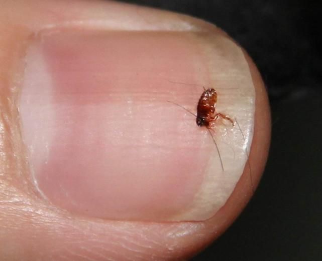 跳蚤长什么样子图片，虱子跳蚤图片（虱子跳蚤咬人的伤口）