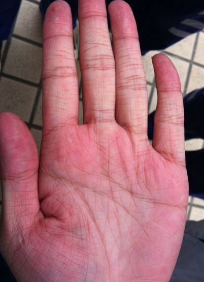 女人手相中的宠爱线,这种手相的人-相术-荣耀易学