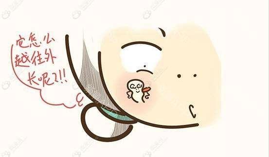 两腮长痘痘是什么原因，两腮长痘痘是什么原因引起的还痒（22种痘痘原因你中招了没有）