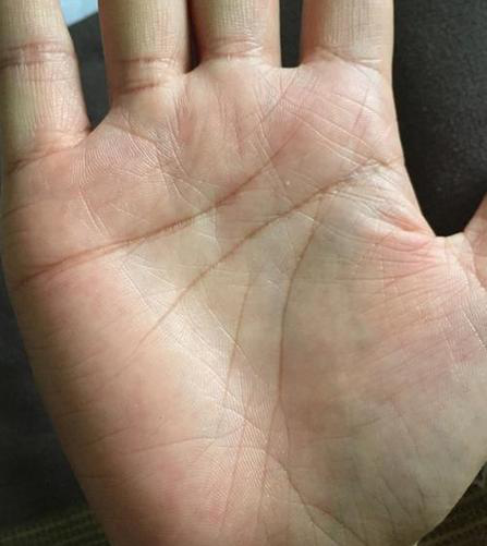 这也是掌纹的一种,一般人不会有的,就是位于大拇指第二节手掌虎口处的