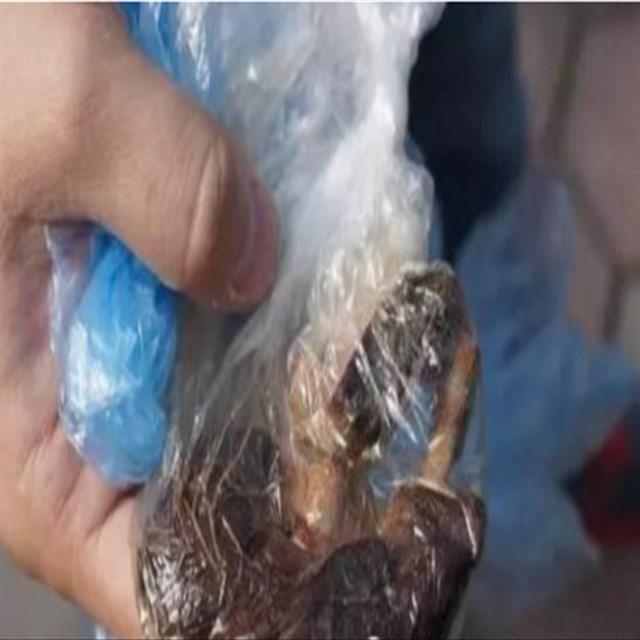 剖腹产以后肚子还很大为什么，剖腹产后肚子还是很大怎么回事（剖腹产后没多久）