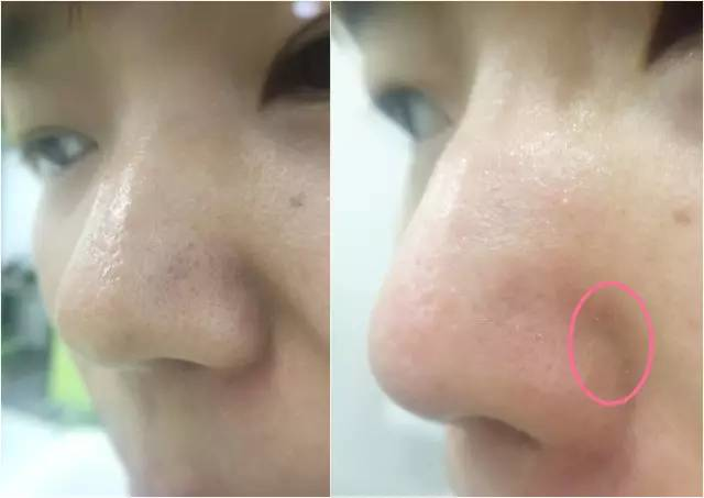 悦诗风吟火山泥面膜，悦诗风吟火山泥面膜多久用一次（亲测8款网红清洁泥膜）