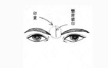 眉毛之间有横纹是什么情况,印堂四种纹路-相术-荣耀易学