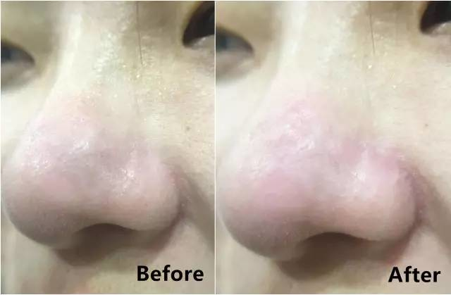 悦诗风吟火山泥面膜，悦诗风吟火山泥面膜多久用一次（亲测8款网红清洁泥膜）